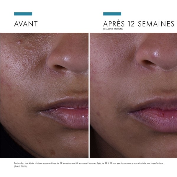 SkinCeuticals Silymarin CF sérum antioxydant