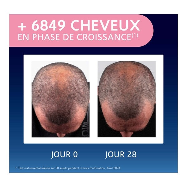 Forcapil Elixir croissance