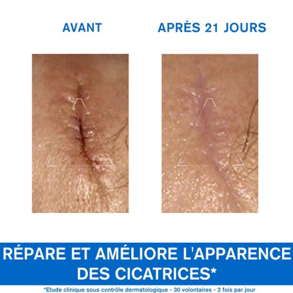 Uriage Bariéderm cica SOS crème réparatrice