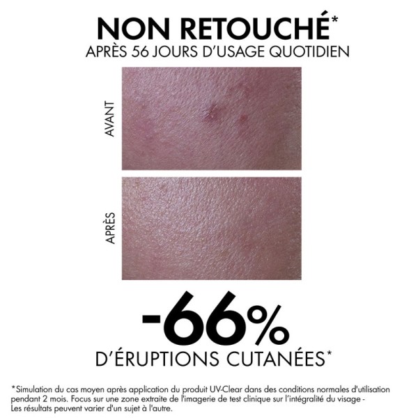 Vichy Capital Soleil UV-clear Fluide anti-imperfections SPF 50+