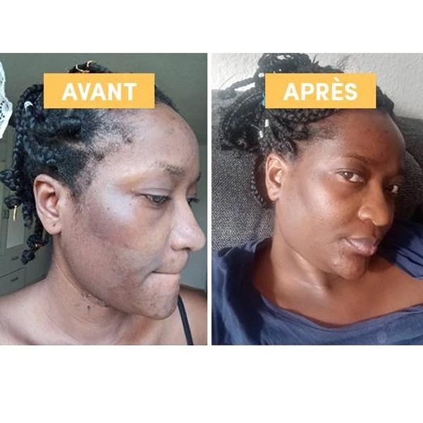 Waam huile de Busserole